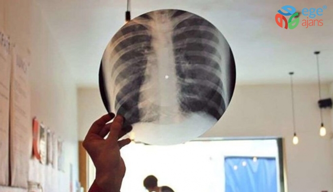 Müzik Yasaklarında Kullanılan Röntgen Plaklar